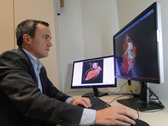 Exame permite o diagnostico precoce de doenças cardiovasculares