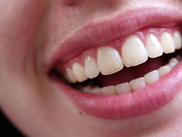 É imprescindível manter uma excelente higienização dos dentes com escova adequada após as principais refeições (Foto: Torli Roberts/FreeImages)