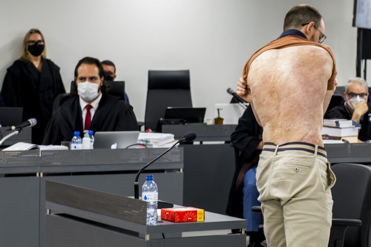 Delvani relatou como foi o princípio do incêndio. Resgatado pelo irmão, ficou dois meses internado. Perdeu três amigos na noite da festa (Foto: Juliano Verardi)