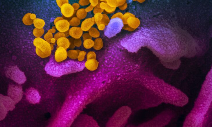 A quantidade de pessoas que pegaram covid-19 ao longo da pandemia foi para 23.585.243 (Foto: NIAID/Agência Brasil)