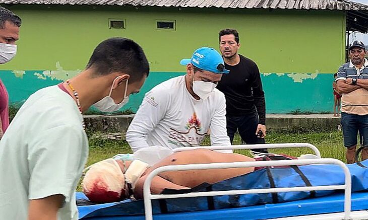 Ataque ocorreu na tarde de sábado – Foto-Júnior Hekurari/Instagram