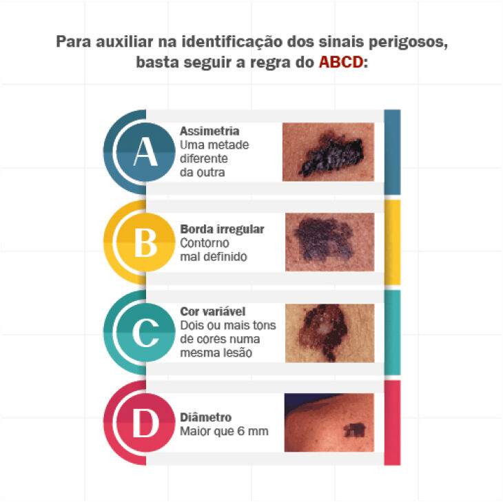 Confira na imagem acima os sinais que devem ser observados no autoexame